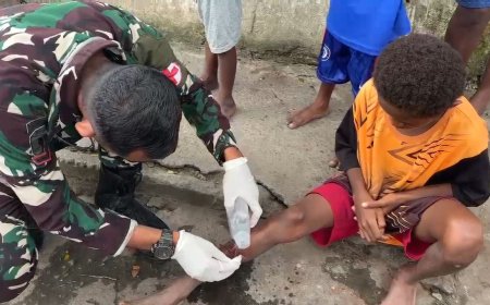 Yonif TP 820/DAAI Gelar Bhakti Kesehatan dan Edukasi PHBS, Wujud Nyata Kepedulian TNI untuk Masyarakat Mimika